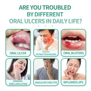 <span class=keywords><strong>Gel</strong></span> Bucal Portátil con Hierbas Antibacterianas para Aliviar el Dolor de Muelas, Dolor Oral, Dolor Periodontal, Úlceras Aftosas y Ampollas - Product Image 5
