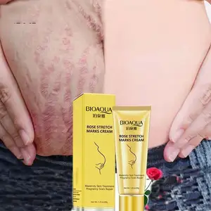 Oem Bioaqua Private Label Wholesale Custom Herba Essence Remover Striae Verwijderingscrème Na De Zwangerschap