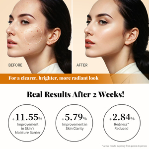 Kojik asit zerdeçal anti-kırışıklık dengeleyici dengeleme kapsül Serum Niacinamide hidrasyon yüz sorunlu cilt gözenek rahatlatır - Product Image 5