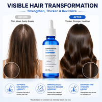 Traitement nourrissant avancé pour la repousse des cheveux, huile capillaire au peptide de cuivre GHK-Cu AHK-Cu, formule 2-en-1 pour la croissance des cheveux, soin du cuir chevelu, plus épais