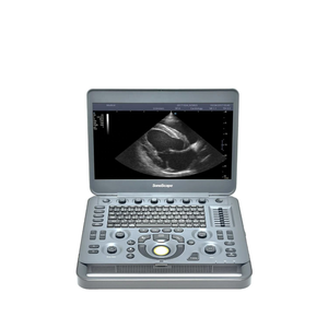 Портативный цветной Доплеровский Ультразвуковой Сканер - Product Image 5