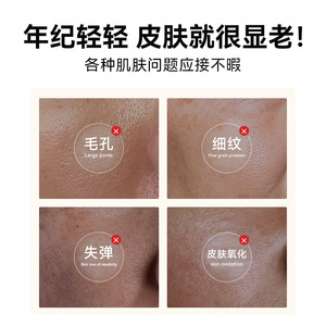 Aplicación Reparadora de Piel con Colágeno Humano Recombinante Médico Dr. Kaiteling, 5 ml * 3, Regeneración de Barrera Cutánea - Product Image 2