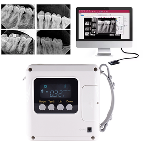 Unidad de Rayos X Dental, Equipo de Rayos X Digital Portátil Completo con Sensor para Clínicas Veterinarias y Dentales - Product Image 6
