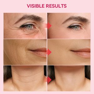 Baume multi-usages au collagène rose PDRN, stick d'essence PDRN, gel au collagène PDRN, soin <span class=keywords><strong>anti</strong></span>-âge, éclaircissant et raffermissant pour la peau - Product Image 3