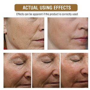 Sérum de Soin Anti-Âge Hydratant et Réducteur de Rides à l'Or 24K et aux Vitamines pour la Peau - Vente en Gros - Product Image 5