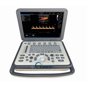 เครื่องอัลตราซาวนด์สำหรับคนและสัตว์ที่เชื่อถือได้ พร้อมคีย์บอร์ดตามหลักสรีรศาสตร์ และระบบจัดการภาพที่ครบครัน เครื่องสแกนอัลตราซาวนด์ PW,PDI รุ่น CU36 - Product Image 3