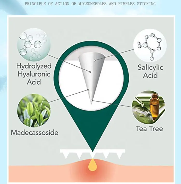 microdart Pickelpflaster Akne Flecken Frontpflaster zur Entfernung von Akne