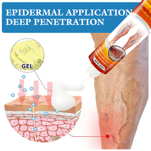 Salep Varises untuk Meredakan Nyeri Kaki dan Mengobati Vaskulitis - Product Image 3