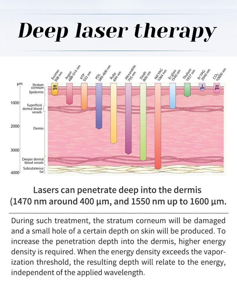 1470nm diode laser