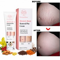 Crème Bio au Beurre de Karité Fermenté et Vitamine E pour l'Élimination des Cicatrices Corporelles, Lissante, Raffermissante et Anti-Vergetures Post-partum
