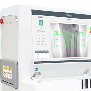 MSL/MEDSINGLONG MSLBD18 Scanner elettrico ad alta precisione per la densità ossea DXA-raggi X a doppia energia per la diagnosi dell'osteoporosi ortopedica - Product Image 3