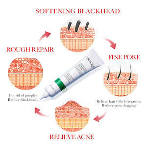 <span class=keywords><strong>Crema</strong></span> Facial Hidratante con Ácido Salicílico para el Acné, Venta al por Mayor para Comercio Exterior Transfronterizo - Product Image 4
