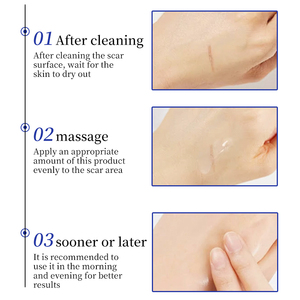 Crème réparatrice en <span class=keywords><strong>silicone</strong></span> pour cicatrices d'acné, boutons et vergetures, gel tenseur pour le visage - Product Image 5
