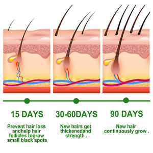 الخروع روزماري باتيانا ريشي النعناع البيوتين والكولاجين والكيراتين شجرة الشاي Vit E الألوة فيرا زيت الجوجوبا - Product Image 4