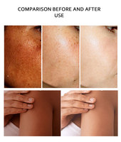 Kit de soin de la peau au glutathion naturel OEM, éclaircissant, blanchissant, illuminateur, anti-âge, meilleur ensemble de produits de soin de la peau biologiques