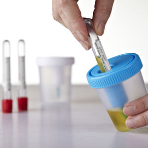 <span class=keywords><strong>Medical</strong></span> Labsพลาสติกทิ้งปัสสาวะคอนเทนเนอร์เข็ม - Product Image 2