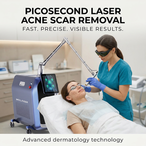 Sistema Laser a Picosecondi per Rimozione Tatuaggi e Smagliature Nd Yag 755nm, <span class=keywords><strong>Trattamento</strong></span> Efficace per la Rimozione Tatuaggi e il <span class=keywords><strong>Trattamento</strong></span> della Pelle Q-Switched - Product Image 1