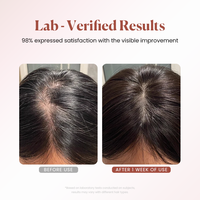 Huile capillaire BEIKE aux plantes, romarin et biotine pour massage du cuir chevelu, traitement favorisant la repousse des cheveux, prévention de la casse, nourrit les cheveux secs et les lisse.