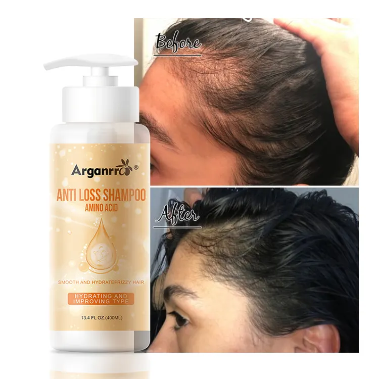 Usine Personnaliser 400Ml D'acide Aminé Humidité Chute De Cheveux Prévenir Anti Perte De Cheveux Ensemble De Shampooing Bio