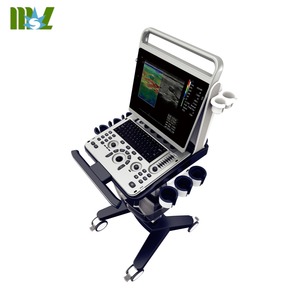 CHISON Ebit50 Medische Echografie-apparaat met <span class=keywords><strong>Trolley</strong></span> Instrumenten MSK Vasculair 4D Digitale <span class=keywords><strong>Trolley</strong></span> Kleuren <span class=keywords><strong>Doppler</strong></span> Echografie - Product Image 5