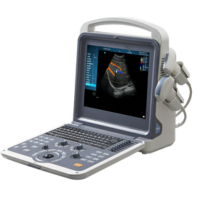 Système d'<span class=keywords><strong>échographie</strong></span> Doppler couleur numérique 4D portable professionnel pour ordinateur portable - Prend en charge plusieurs sondes, certifié CE - Product Image 4