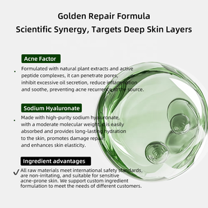 Suero Profesional para el Tratamiento del Acné 5ml - Control de Grasa y Eliminación de Imperfecciones con Factores Hidratantes - para Salones de Cuidado de <span class=keywords><strong>la</strong></span> <span class=keywords><strong>Piel</strong></span> - Product Image 3