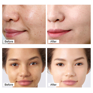 Crema Facial Hidratante, Blanqueadora, Antiarrugas y Reparadora con Retinol al 3%, Colágeno y Aceite de Jojoba, Orgánica y Natural, Marca Blanca - Product Image 6