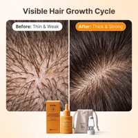 Sérum Capillaire Personnalisé à l'Huile de Romarin et Peptides Liposomales pour la Croissance des Cheveux, Nourrissant Doucement le Cuir Chevelu, à la Biotine, Certifié GMPC, Marque Privée OEM