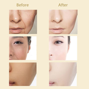 Crema di merlano al collagene lumaca più venduta per lo sbiancamento del viso crema naturale per il viso e lozione - Product Image 6