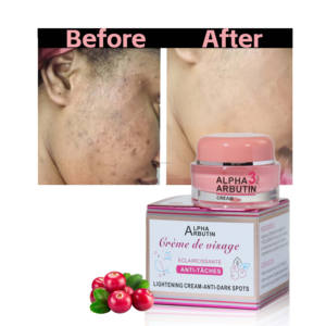 Crema Viso OEM con Vitamina E e Arancia per Schiarire la Pelle, Rimuovere le Macchie e le Cicatrici, Prodotti per la Cura del Viso - Product Image 4