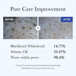 Medicube Zero Pore Blackhead Mud Gesichtsmaske - Hautkühlung & Porenverengung - 3 Minuten Schnelltrocknende Formel mit AHA, BHA, PHA - Product Image 5