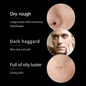 Productos <span class=keywords><strong>para</strong></span> el Cuidado de la Piel Masculina de Marca Privada VEZE, Tratamiento <span class=keywords><strong>para</strong></span> el Acné, Reparación, Control de Grasa, Set de Cuidado de la Piel <span class=keywords><strong>para</strong></span> Hombres - Product Image 5