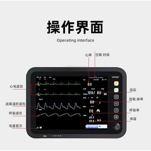 Monitor de ECG portátil Yd-V9000, monitor multiparamétrico para pacientes con batería incorporada para uso hospitalario, certificado CE. - Product Image 3