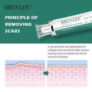 ครีมลบรอยแผลเป็น BREYLEE ครีมบำรุงผิวหน้า สำหรับรอยแผลเป็นจากสิว รอยแตกลาย รักษาหลังคลอด ฟื้นฟูผิวหน้า - Product Image 5