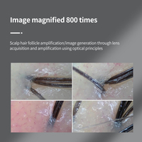 Détecteur de follicule pileux haute définition détecteur de peau analyseur de cheveux de cuir chevelu portable poids 30g