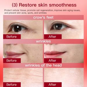 Suero Facial Blanqueador con Dendrobium y Hexapéptidos, Antiedad y Antiarrugas, Bajo MOQ - Product Image 3