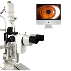 Solution d'imagerie pour lampe à fente ophtalmologique Phoenix avec exposition automatique pour examens ophtalmologiques cliniques et hospitaliers - Product Image 3