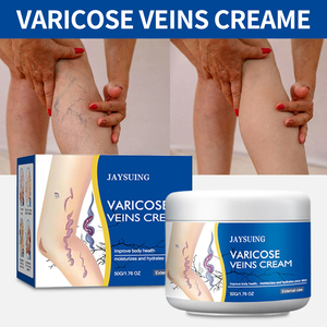 Crema JAYSUING para <span class=keywords><strong>venas</strong></span> varicosas, alivia <span class=keywords><strong>las</strong></span> <span class=keywords><strong>arañas</strong></span> vasculares, calma la hinchazón y el dolor, ungüento hidratante para el cuidado de <span class=keywords><strong>las</strong></span> <span class=keywords><strong>piernas</strong></span>, para uso externo, 50g - Product Image 2
