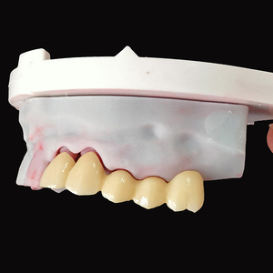OEM/ODM servizi di laboratorio odontoiatrico perfetto aspetto belle corone in ceramica di <span class=keywords><strong>Zirconia</strong></span> con gomma realistica in Cina laboratorio odontoiatrico - Product Image 3