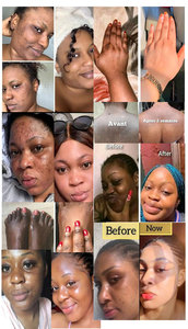 Juego de Cuidado Facial Vegano Natural de Cúrcuma de Marca Privada para Blanquear e Iluminar la Piel, Hidratación Profunda para Mujeres Negras - Product Image 2