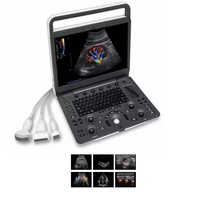 Échographe portable Sonoscape Vet E1 E2 E2v, échographe Doppler couleur Sonoscape