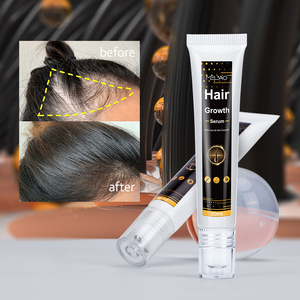 Aceite <span class=keywords><strong>para</strong></span> <span class=keywords><strong>el</strong></span> crecimiento del cabello, productos <span class=keywords><strong>para</strong></span> <span class=keywords><strong>el</strong></span> crecimiento del cabello <span class=keywords><strong>para</strong></span> mujeres negras, suero <span class=keywords><strong>para</strong></span> <span class=keywords><strong>el</strong></span> crecimiento del cabello con rodillo - Product Image 3