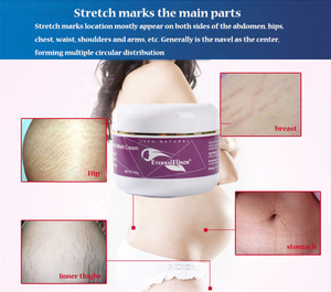 Crème Réparatrice Visage et Corps Anti-Vergetures et Cicatrices de Grossesse au Beurre de Karité et Vitamine B5 - Product Image 5