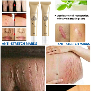 Crema Herbal para el Cuidado de Cicatrices al por Mayor, Crema Calmante y Reparadora para Marcas de Imperfecciones y Estrías - Product Image 4