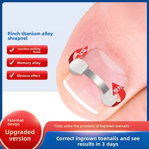 Dispositif de correction des ongles avec fragment osseux bionique en alliage nickel-titane et ensemble de fils d'acier - Style universel <span class=keywords><strong>pour</strong></span> les ongles incarnés - Product Image 5