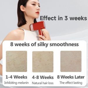 MLAY เครื่องกำจัดขน IPL แบบพกพา รุ่นใหม่ล่าสุด สำหรับการฟื้นฟูผิวถาวร ด้วยเทคโนโลยีเลเซอร์ IPL ให้ผลลัพธ์รวดเร็ว ใช้ได้ที่บ้าน - Product Image 6