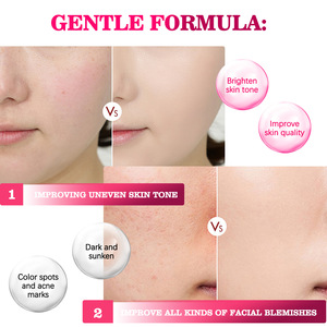 Creme Removedor de Manchas Escuras com Arbutin, Ácido Kójico e Niacinamida para Rosto e Corpo - Clareador e Hidratante 50ml - Product Image 6
