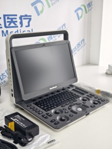 Ecógrafo de Diagnóstico Portátil en Blanco y Negro Sonoscape E1V para Equinos, Ovejas, Vacas y Mascotas con Batería Integrada, Ultrasonido Veterinario - Product Image 4