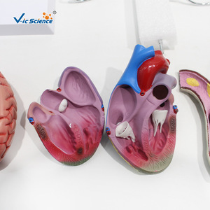 Modelo de diabetes, modelo de anatomía humana, modelo patológico, modelo médico de lesiones - Product Image 3
