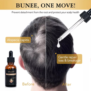 Vente en gros de produits pour la perte de cheveux en afrique, produits de soins capillaires de marque privée 100% naturels, huile de sérum de croissance des cheveux 30ml